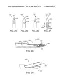 Systems and Methods for Needle Access to an Intervertebral Disc diagram and image