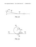 Systems and Methods for Needle Access to an Intervertebral Disc diagram and image