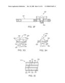 Systems and Methods for Needle Access to an Intervertebral Disc diagram and image