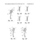 Transseptal closure of a patent foramen ovale and other cardiac defects diagram and image