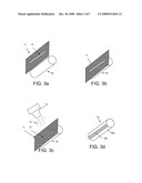 Method for Marking Orthopedic Implant diagram and image