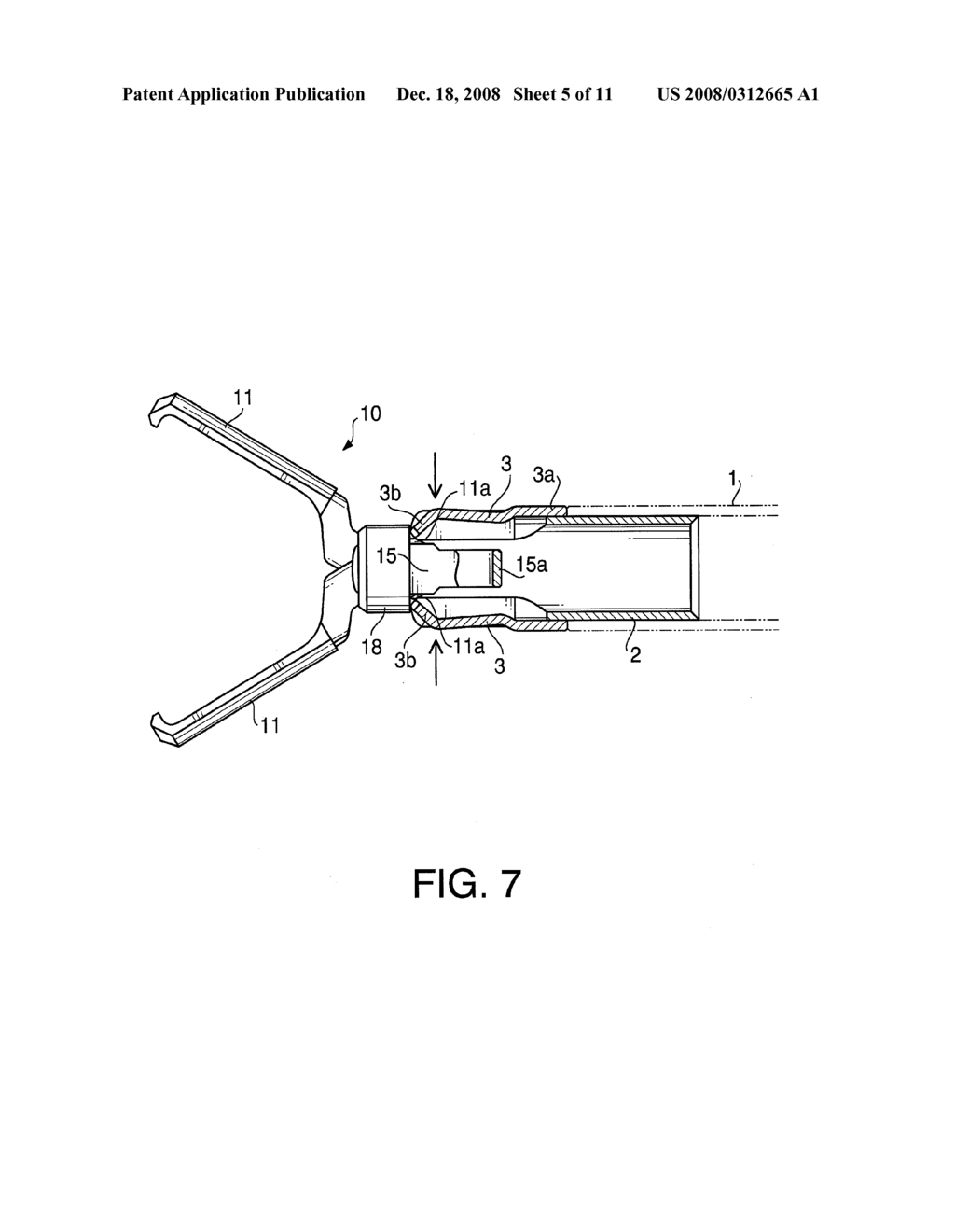 CLIPPING INSTRUMENT FOR AN ENDOSCOPIC SURGICAL DEVICE - diagram, schematic, and image 06