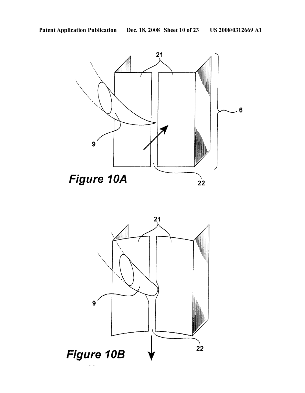 SURGICAL INSTRUMENT AND METHOD - diagram, schematic, and image 11