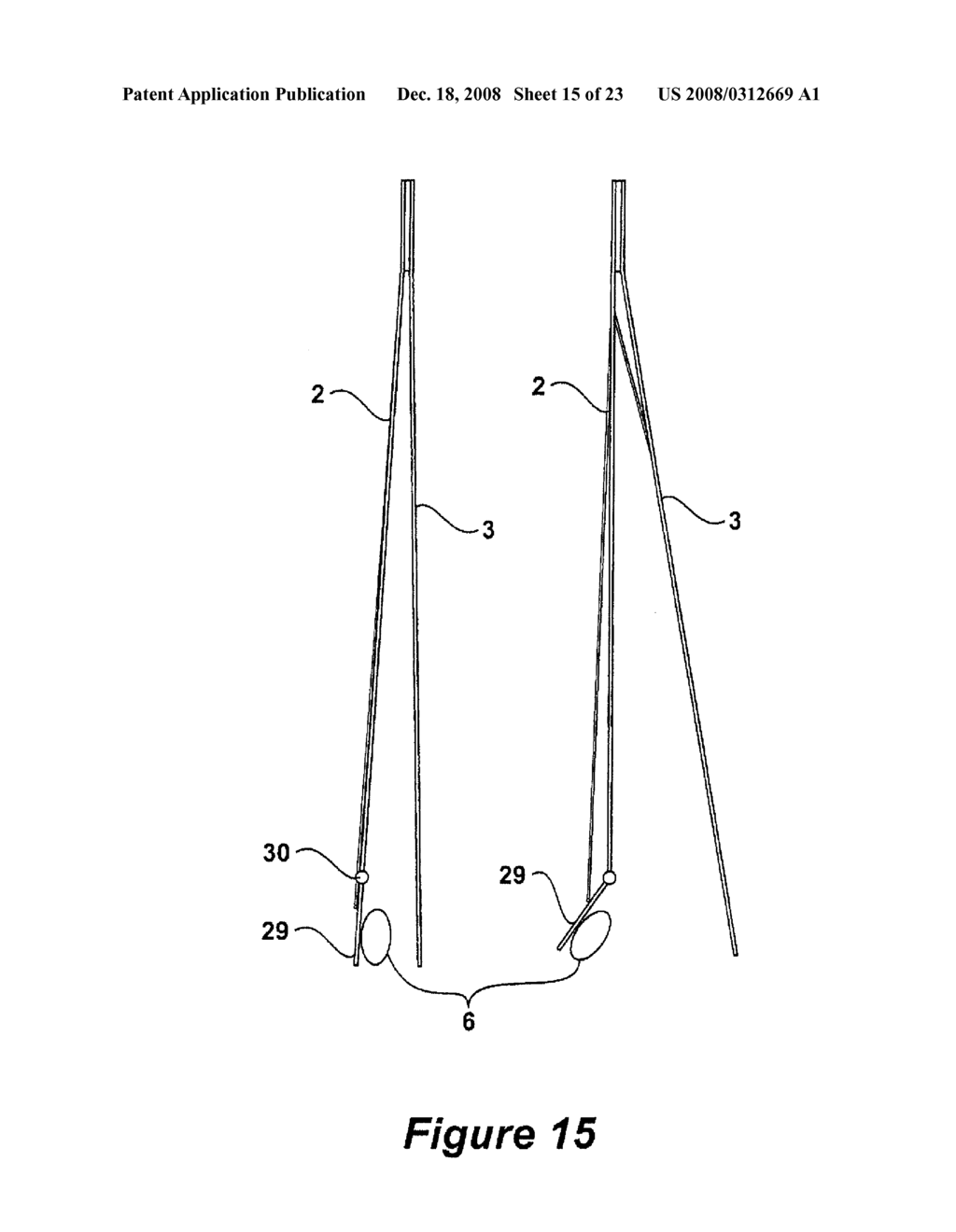 SURGICAL INSTRUMENT AND METHOD - diagram, schematic, and image 16