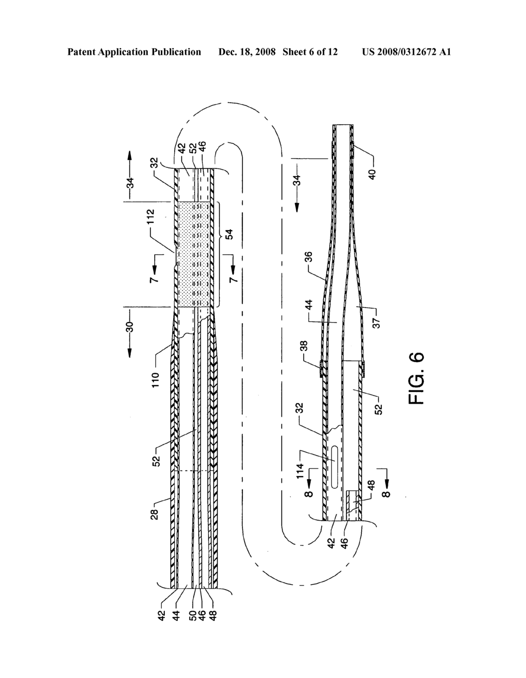 Forwardly directed fluid jet crossing catheter - diagram, schematic, and image 07