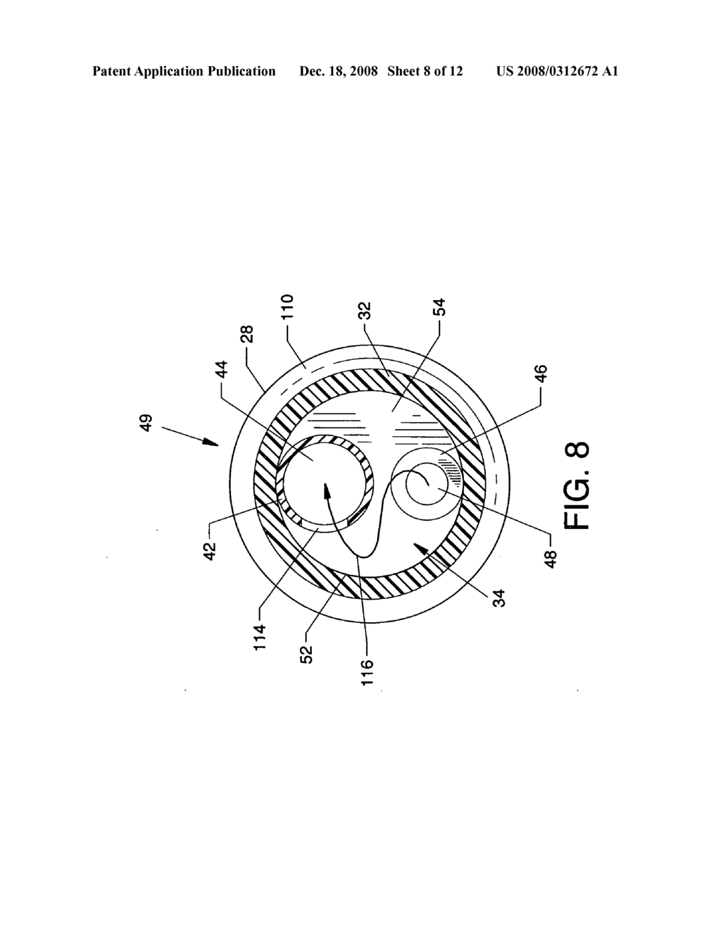 Forwardly directed fluid jet crossing catheter - diagram, schematic, and image 09