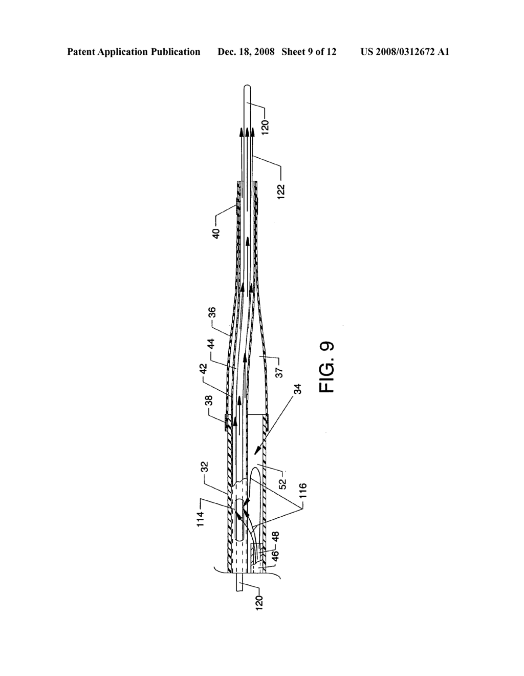 Forwardly directed fluid jet crossing catheter - diagram, schematic, and image 10