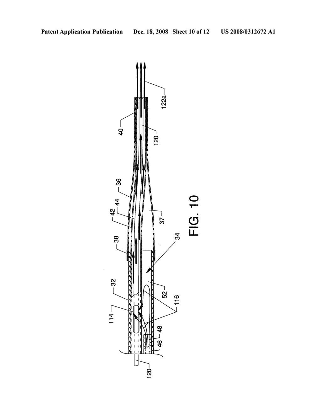 Forwardly directed fluid jet crossing catheter - diagram, schematic, and image 11