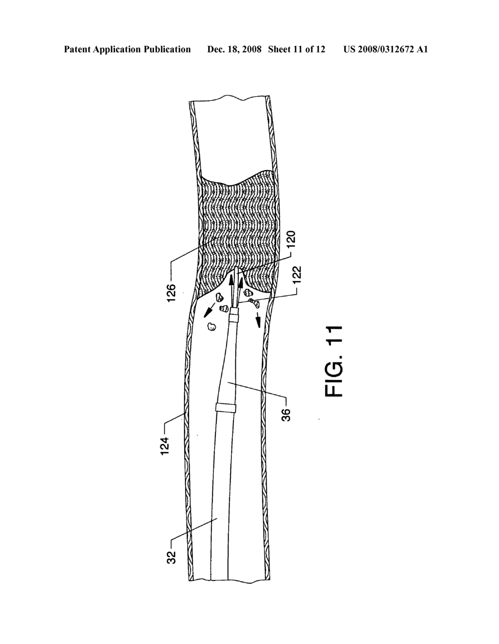 Forwardly directed fluid jet crossing catheter - diagram, schematic, and image 12