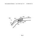 Method and apparatus for CTO crossing diagram and image