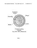 Method and apparatus for CTO crossing diagram and image