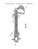 ANTIMICROBIAL CLOSURE ELEMENT AND CLOSURE ELEMENT APPLIER diagram and image