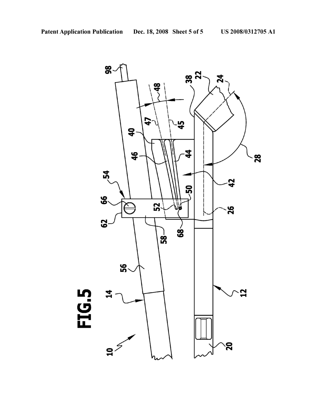 SURGICAL GUIDING INSTRUMENT - diagram, schematic, and image 06