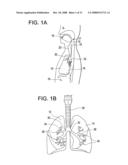 Implantable Devices and Methods for Stimulation of Cardiac or Other Tissues diagram and image