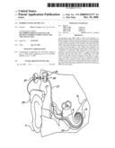 Hybrid Cochlear Implant diagram and image