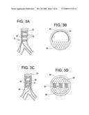 Implantable Devices And Methods For Stimulation Of Cardiac And Other Tissues diagram and image