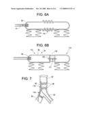 Implantable Devices And Methods For Stimulation Of Cardiac And Other Tissues diagram and image