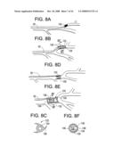 Implantable Devices And Methods For Stimulation Of Cardiac And Other Tissues diagram and image