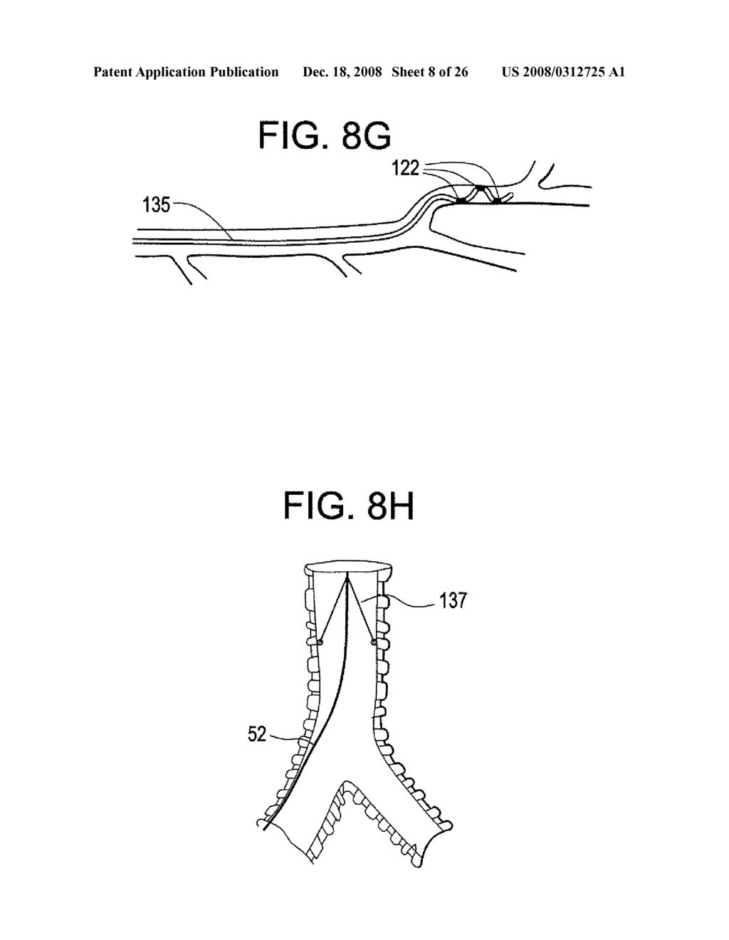 Implantable Devices And Methods For Stimulation Of Cardiac And Other Tissues - diagram, schematic, and image 09