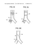 Implantable Devices And Methods For Stimulation Of Cardiac And Other Tissues diagram and image