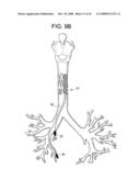 Implantable Devices And Methods For Stimulation Of Cardiac And Other Tissues diagram and image