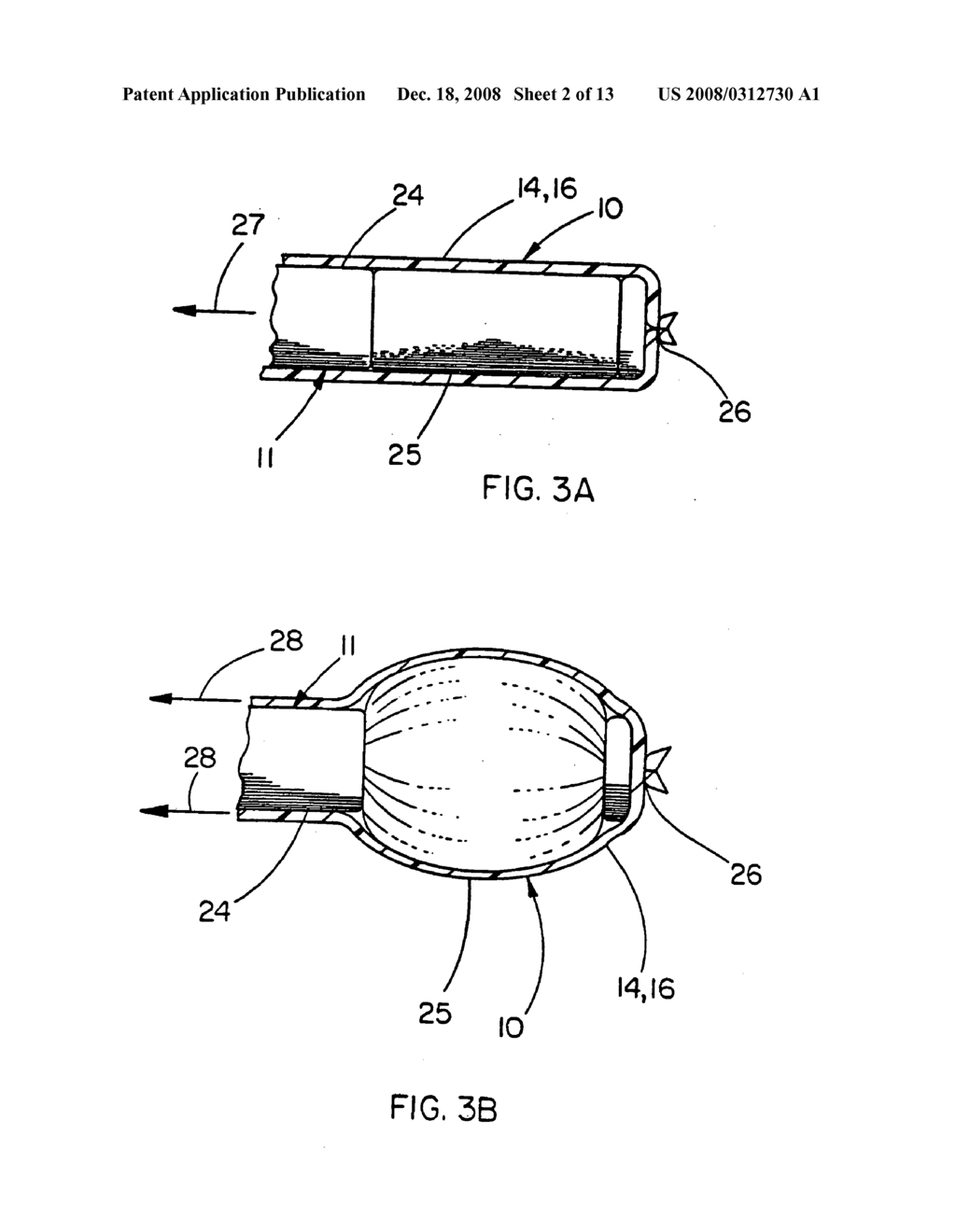 BALLOON CATHETER DEVICE - diagram, schematic, and image 03