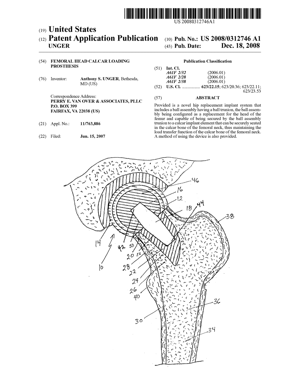 FEMORAL HEAD CALCAR LOADING PROSTHESIS - diagram, schematic, and image 01