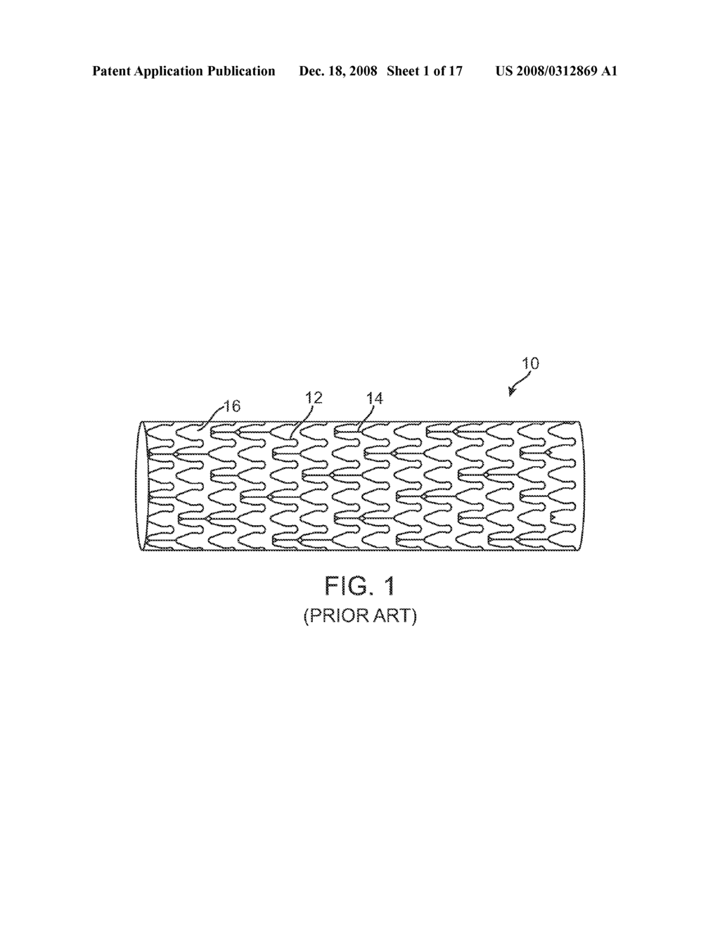 METHOD AND APPARATUS FOR WEIGHING A STENT - diagram, schematic, and image 02