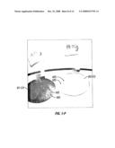 Dispensing Devices and Compositions Therefor diagram and image