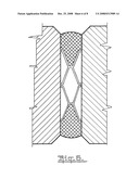 Gap Filling System diagram and image