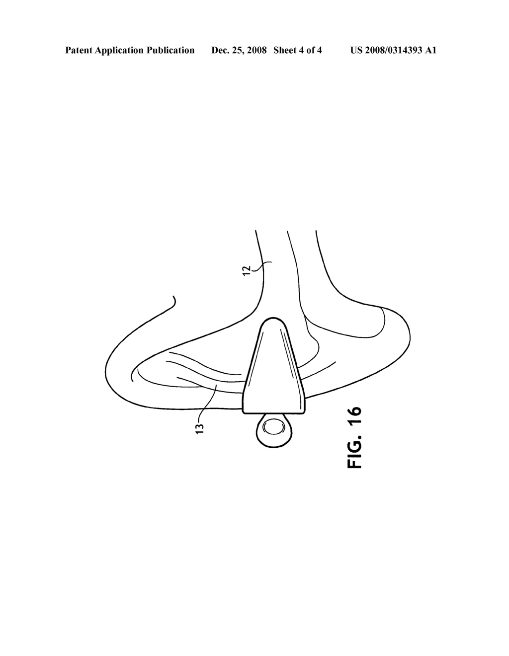 Self-conforming sound attenuation earplug - diagram, schematic, and image 05