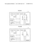 MEDICAL-DIAGNOSIS ASSISTING APPARATUS, MEDICAL-DIAGNOSIS ASSISTING METHOD, AND RADIODIAGNOSIS APPARATUS diagram and image