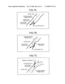 MEDICAL-DIAGNOSIS ASSISTING APPARATUS, MEDICAL-DIAGNOSIS ASSISTING METHOD, AND RADIODIAGNOSIS APPARATUS diagram and image