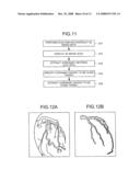 MEDICAL-DIAGNOSIS ASSISTING APPARATUS, MEDICAL-DIAGNOSIS ASSISTING METHOD, AND RADIODIAGNOSIS APPARATUS diagram and image