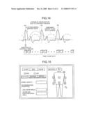 MEDICAL-DIAGNOSIS ASSISTING APPARATUS, MEDICAL-DIAGNOSIS ASSISTING METHOD, AND RADIODIAGNOSIS APPARATUS diagram and image