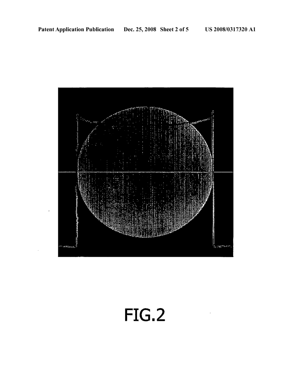 Correction of Artifacts Caused by the Heel Effect - diagram, schematic, and image 03