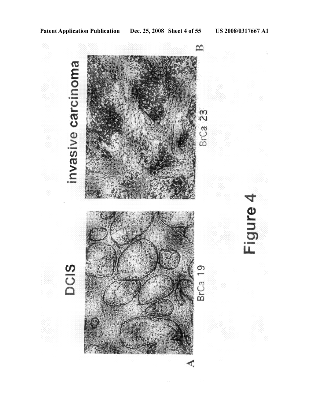 Compositions and methods for inhibiting growth of smad4-deficient cancers - diagram, schematic, and image 05