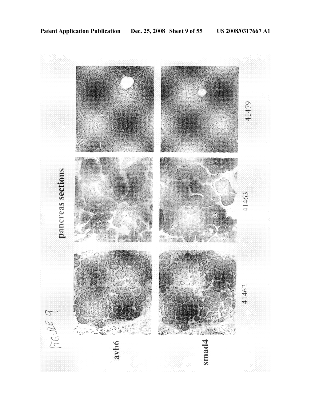 Compositions and methods for inhibiting growth of smad4-deficient cancers - diagram, schematic, and image 10