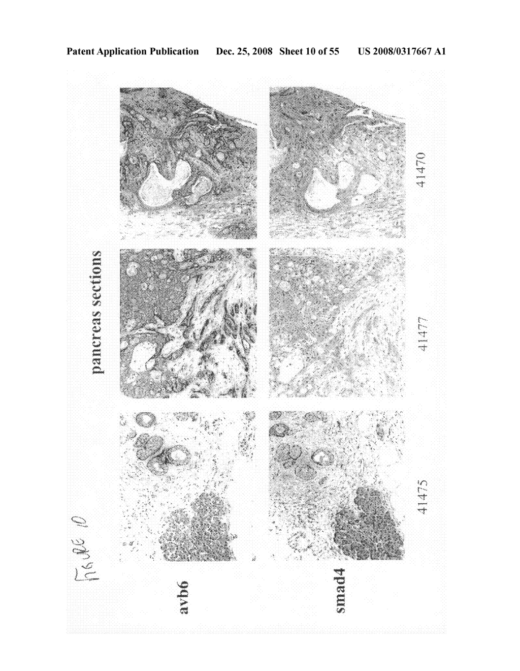 Compositions and methods for inhibiting growth of smad4-deficient cancers - diagram, schematic, and image 11