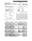 Methods For Treating Autoimmune or Demyelinating Diseases diagram and image