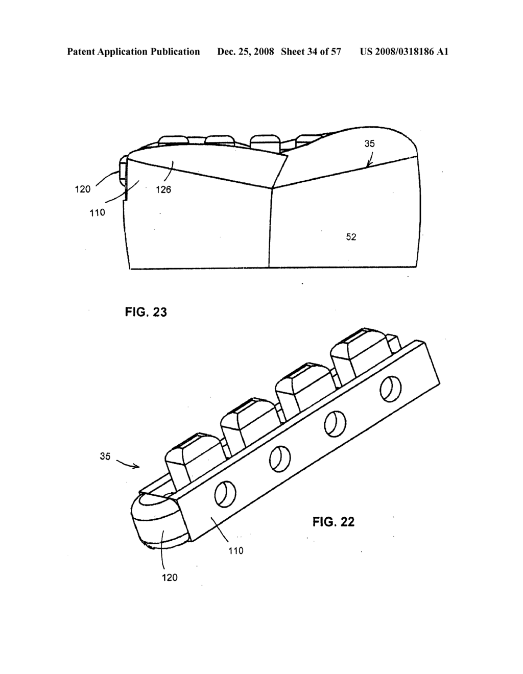 DENTAL DEVICE, SUCH AS A BRIDGE OR INSERT - diagram, schematic, and image 35