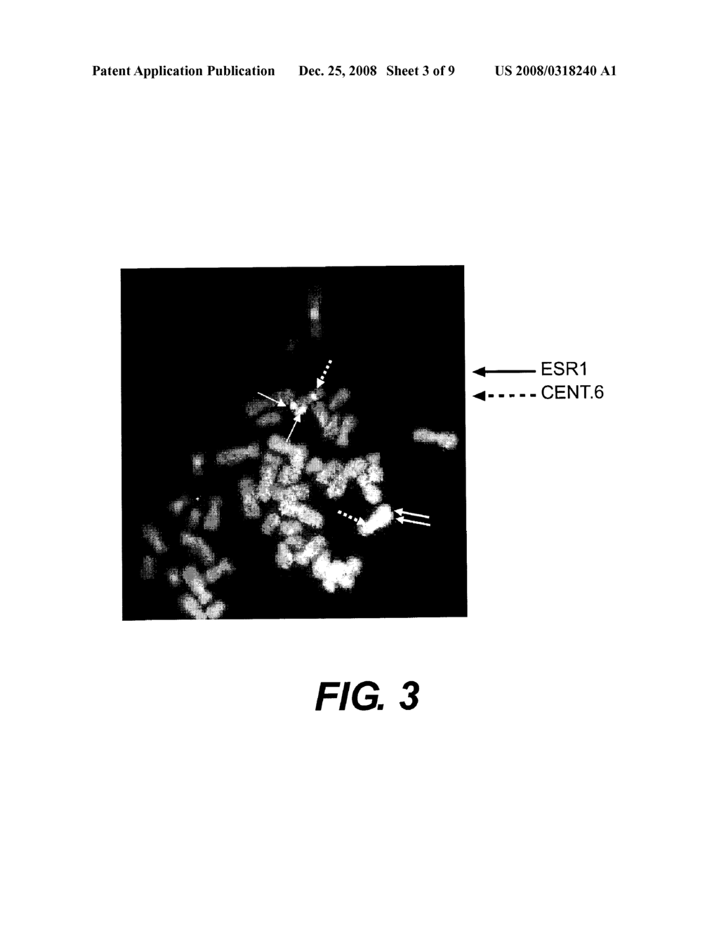 METHODS FOR UTILIZING ESR COPY NUMBER CHANGES IN BREAST CANCER TREATMENTS AND PROGNOSES - diagram, schematic, and image 04