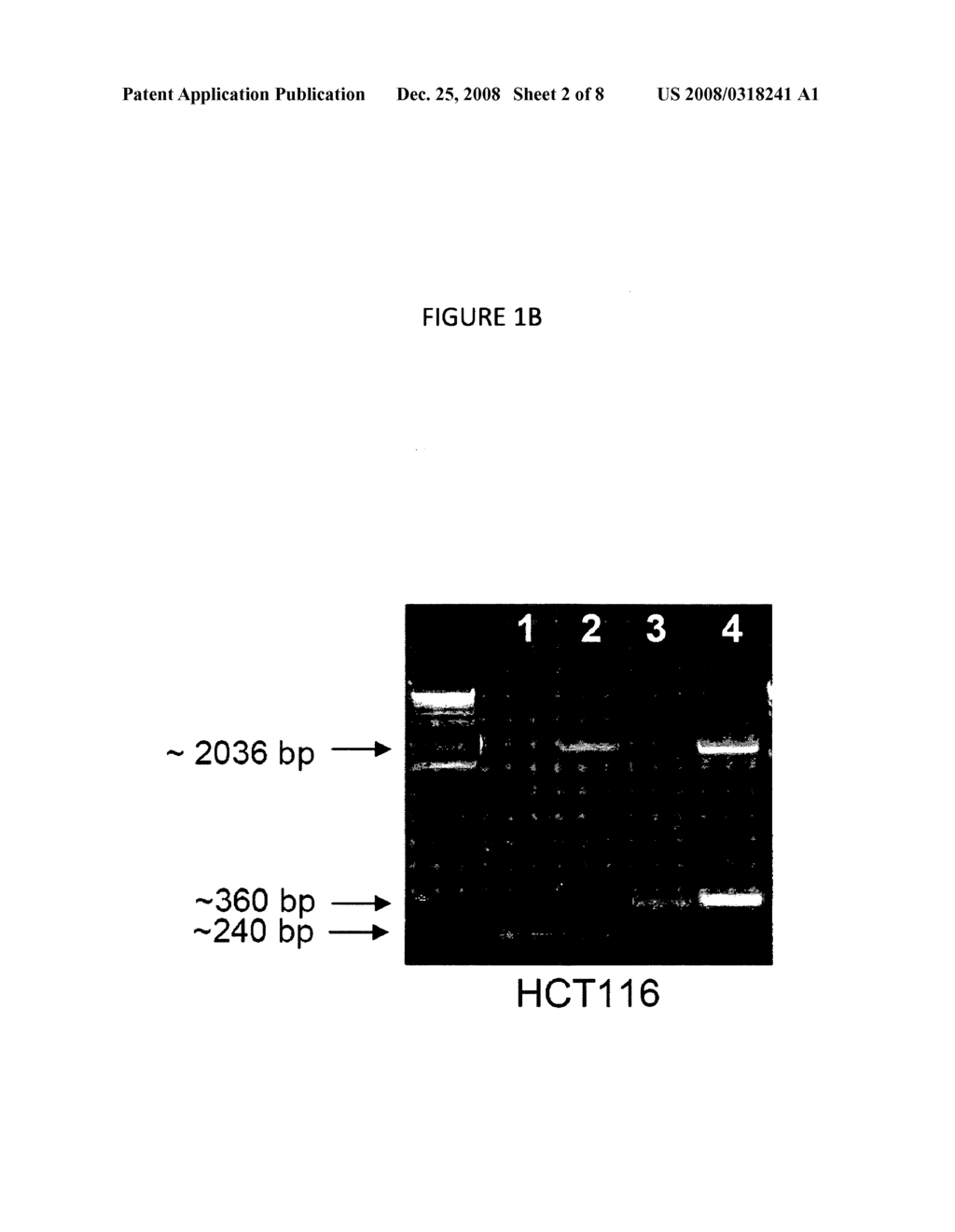 Methods and Systems for Detecting Antiangiogenesis - diagram, schematic, and image 03