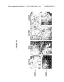 Methods and Systems for Detecting Antiangiogenesis diagram and image