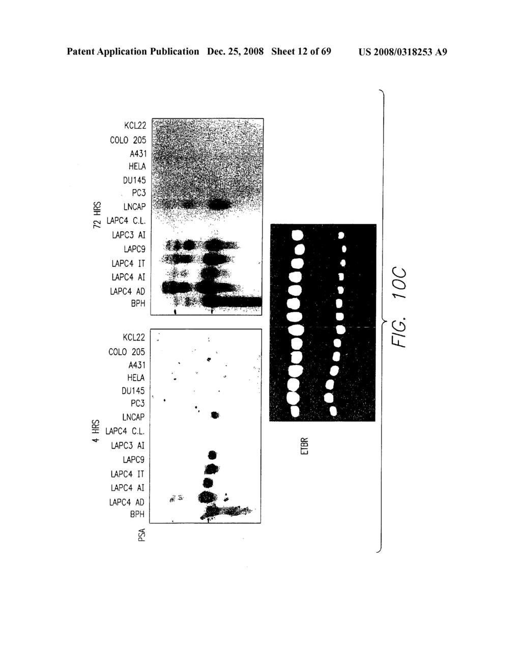 PSCA prostate stem cell antigen and uses thereof - diagram, schematic, and image 13