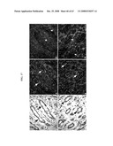 Polynucelotides encoding novel variants of the TRP channel family member, LTRPC3 diagram and image