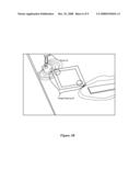 System and Method for Coupling an Integrated Circuit to a Circuit Board diagram and image