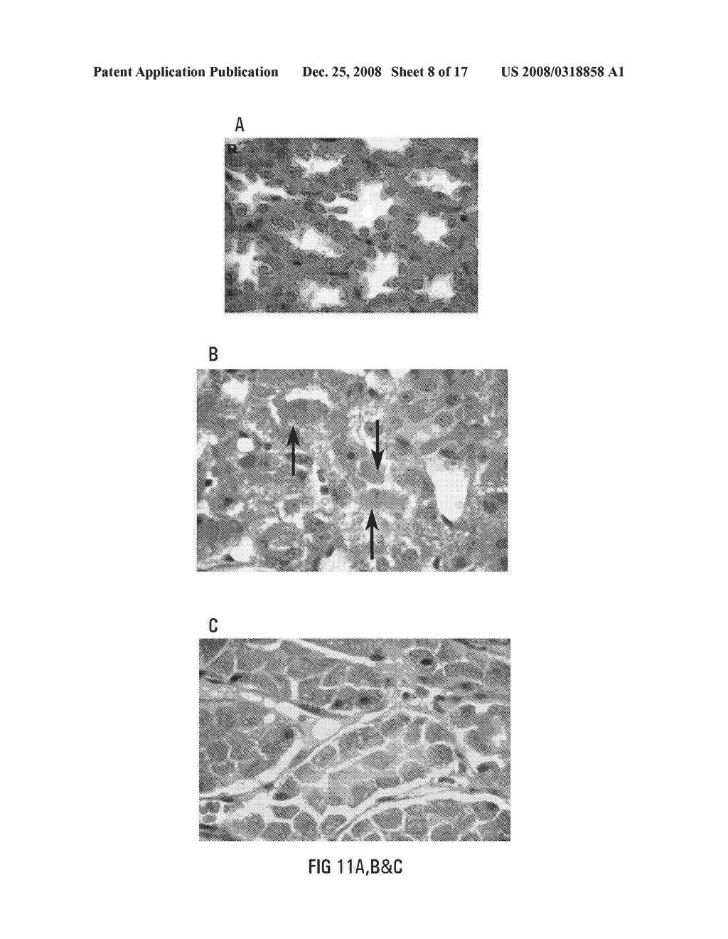 Isolated Recombinant Vaccinia Virus Complement Control Protein (Hrvcp) Polypeptide - diagram, schematic, and image 09