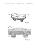 ANTIOXIDANT STABILIZED CROSSLINKED ULTRA-HIGH MOLECULAR WEIGHT POLYETHYLENE FOR MEDICAL DEVICE APPLICATIONS diagram and image