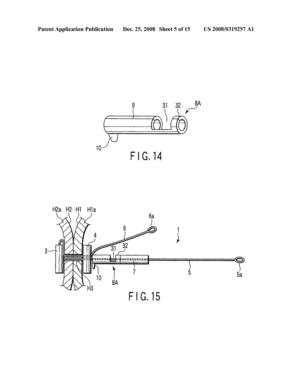 Living body wall fixing tool used in endoscope - diagram, schematic, and image 06